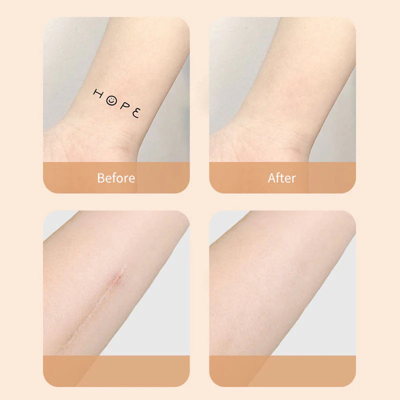 Ultra-Thin Tattoo and Scar Concealer Patch (12 pcs)